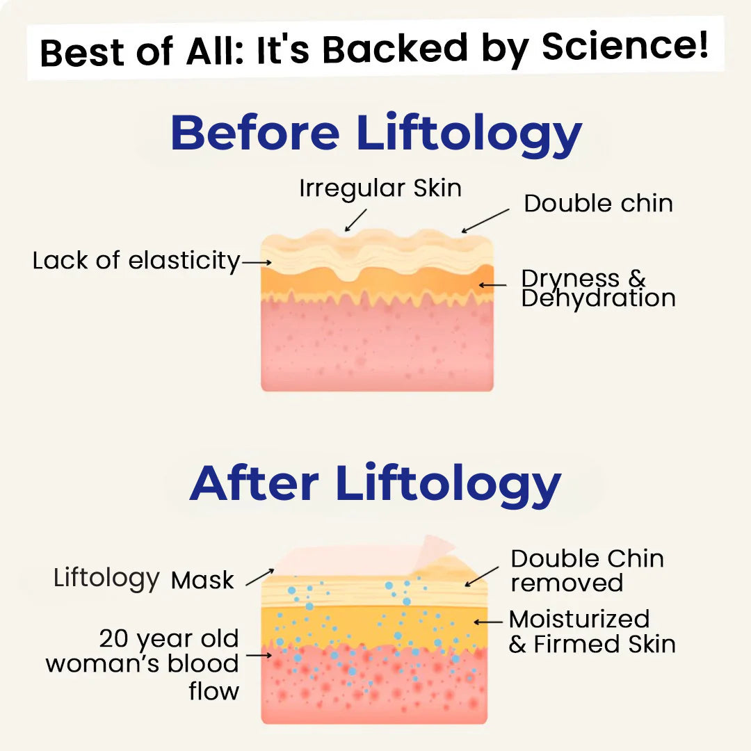 Liftology